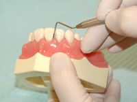 歯ぐきの検査