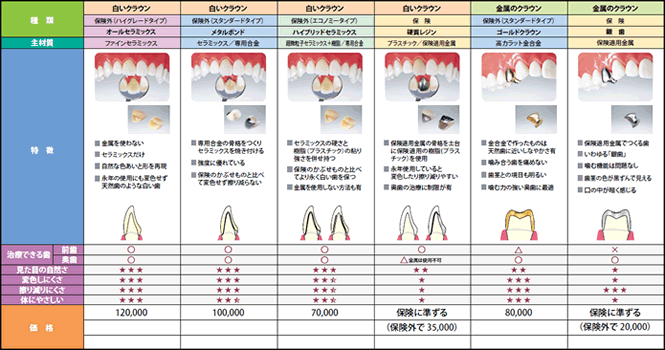 クラウン（かぶせもの）料金表