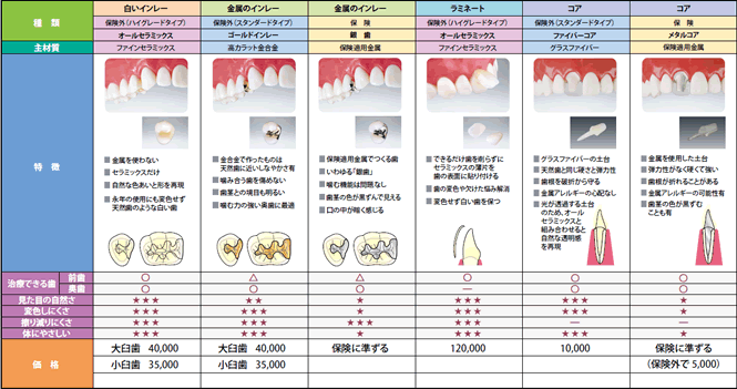 インレー（つめもの）・ラミネート・コア料金表